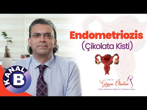 Endometriozis (Çikolata Kisti)